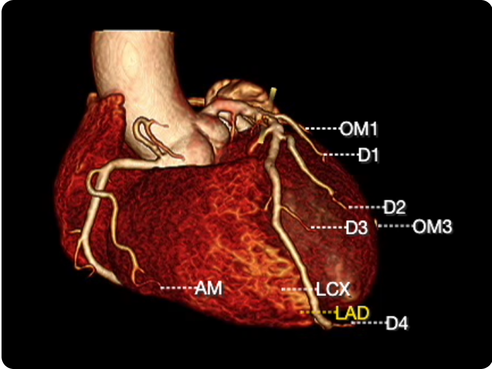 CT Angiography Case Study